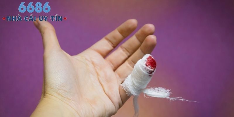 Giải nghĩa cụ thể 4 tình huống mơ thấy máu phổ biến